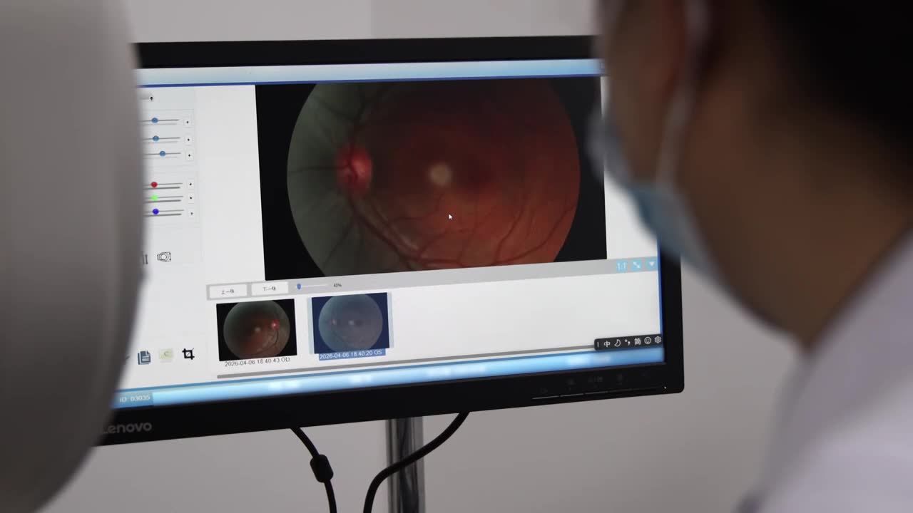 医院医生在为患者进行眼底镜检查  眼科检查 眼底图像 视网膜检查视频素材画面1