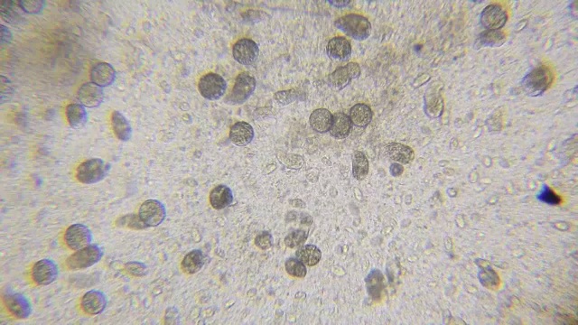 通过显微镜观察藻类衣藻、纤毛草虫和许多细菌视频素材画面1