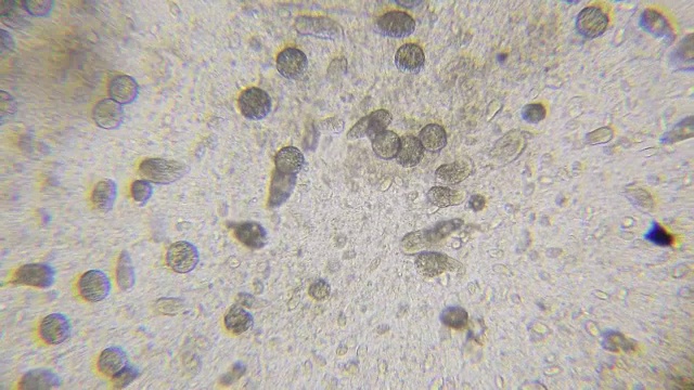 通过显微镜观察藻类衣藻、纤毛草虫和许多细菌视频素材画面2