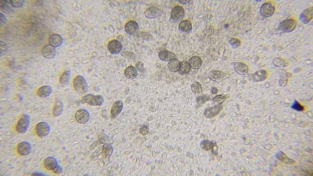 通过显微镜观察藻类衣藻、纤毛草虫和许多细菌视频素材画面3