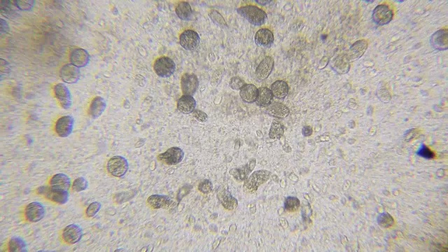 通过显微镜观察藻类衣藻、纤毛草虫和许多细菌视频素材画面4
