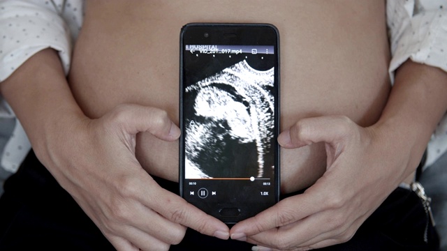 孕妇在智能手机上播放3D超声波视频视频素材画面1