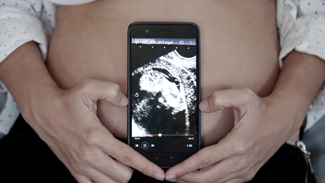 孕妇在智能手机上播放3D超声波视频视频素材画面2