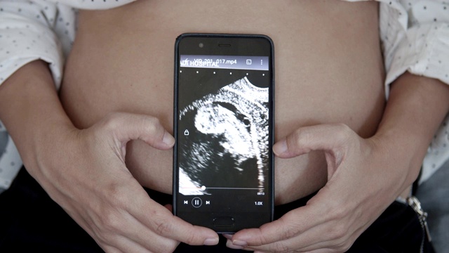 孕妇在智能手机上播放3D超声波视频视频素材画面3