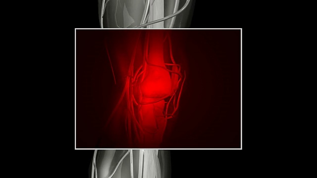 膝盖疼痛视频素材