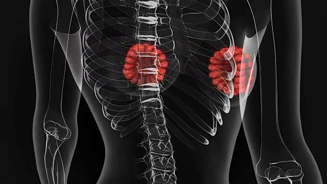 乳腺视频素材画面1
